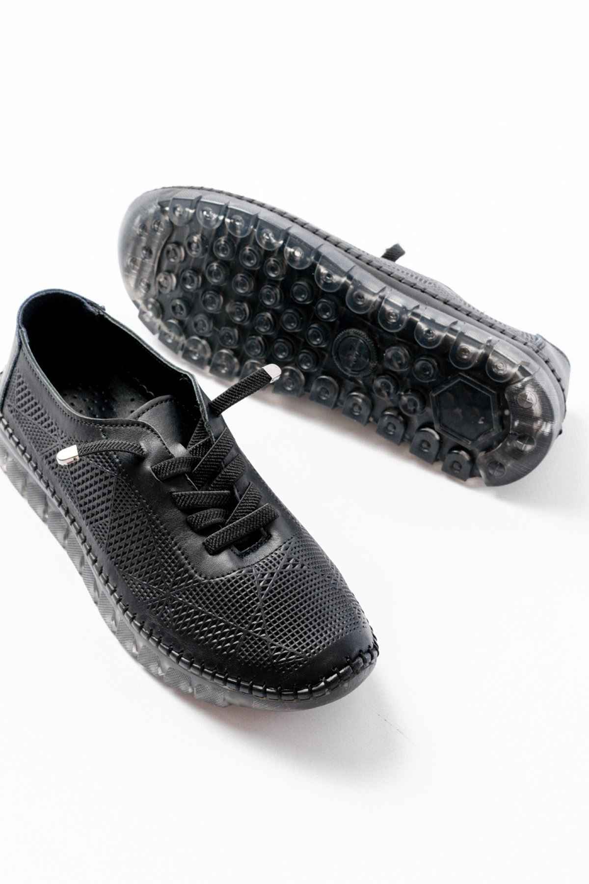 Ayakkabı Aşkı S-365  Siyah Desenli Hakiki Deri Şeffaf Taban Kadın Spor Ayakkabı